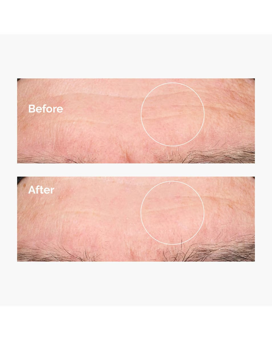 THE ORDINARY - Acide Hyaluronique 2% + B5 - 30ml