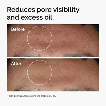 THE ORDINARY - Niacinamide 10% + Zinc 1% - 30ml